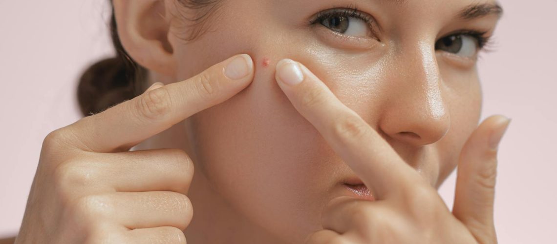 Furoncle visage : causes, symptômes, faut-il le percer ?